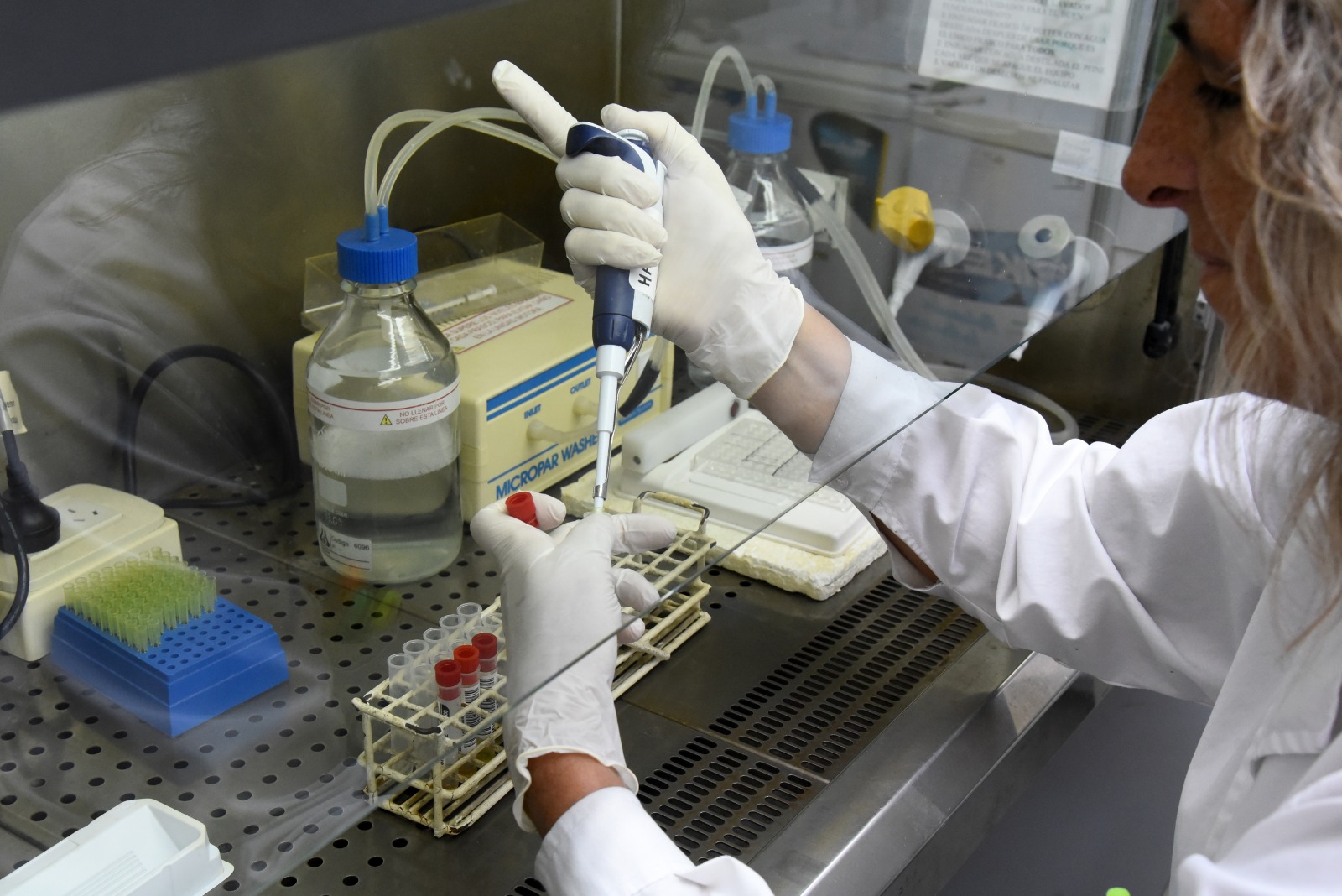 La Encefalitis Equina del Oeste se podrá detectar en laboratorios públicos de la Provincia