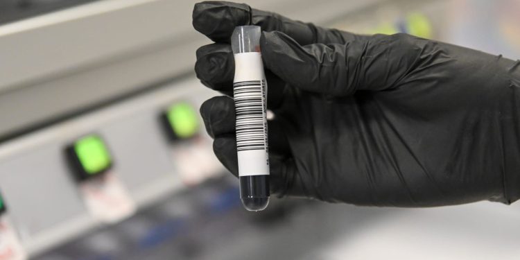 Estudios genéticos de cáncer: Santa Fe es la única provincia que los garantiza en la salud pública y se posiciona como referente nacional.