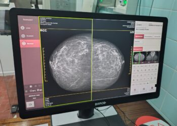 Villa Ocampo: Un sueño cumplido: el Mamógrafo ya es una realidad.