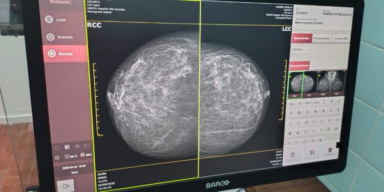 Villa Ocampo: Un sueño cumplido: el Mamógrafo ya es una realidad.