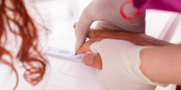 Día de Respuesta al VIH: en dos años, Provincia compró más de 5.100.000 preservativos.